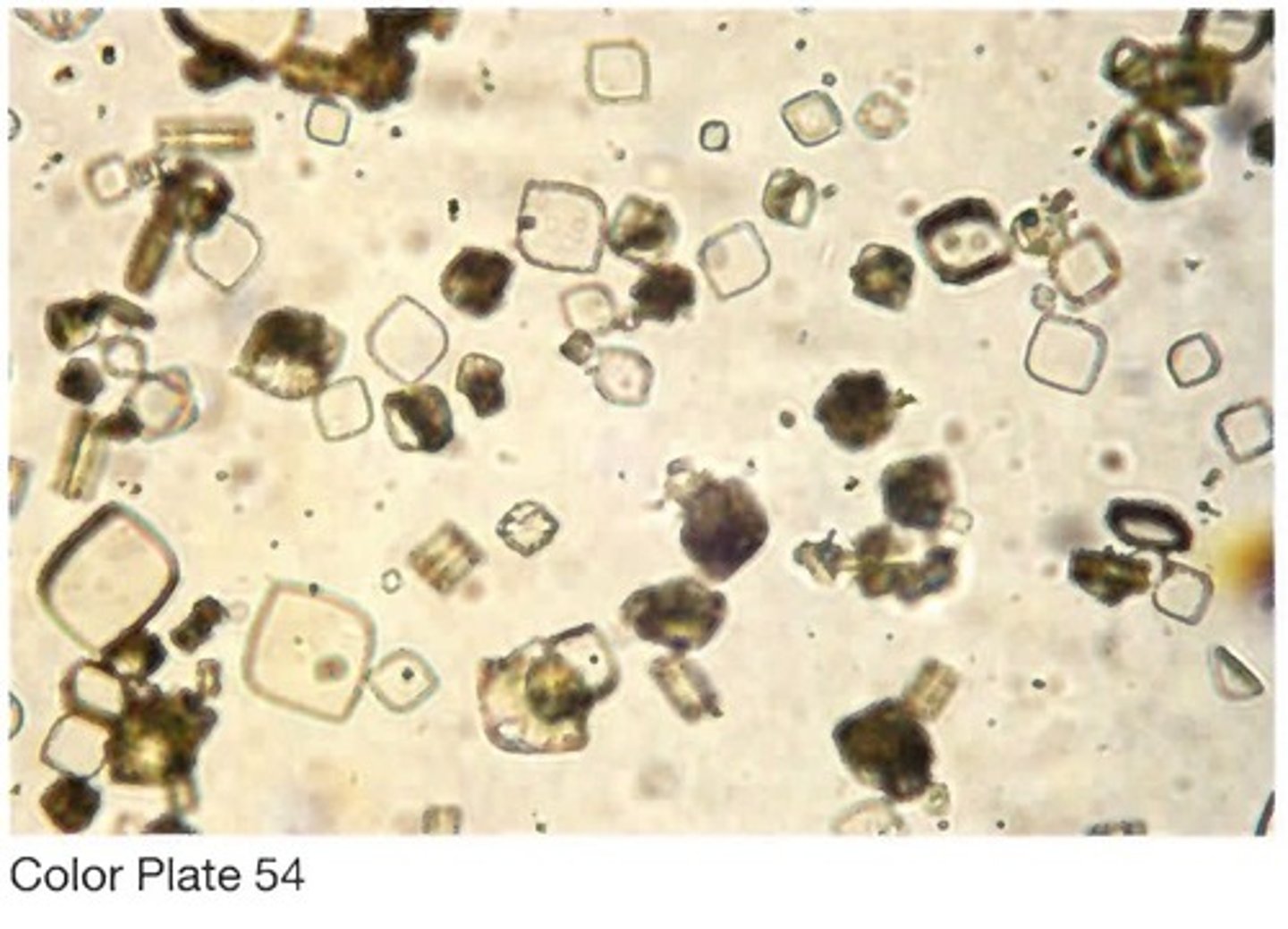 <p>B. Can also resemble cysteine crystals</p>