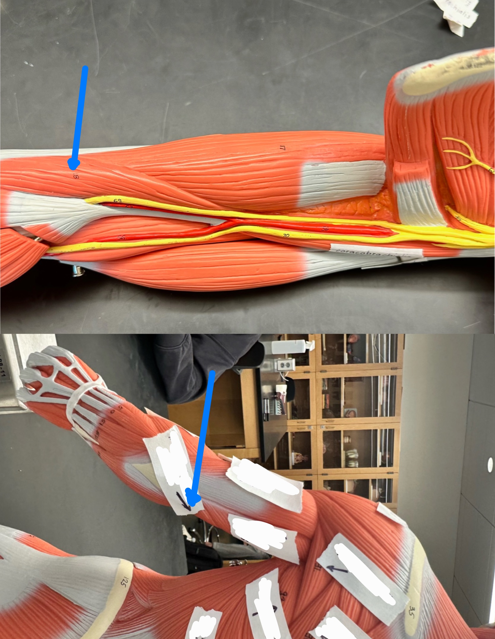 <p>ID muscle</p>