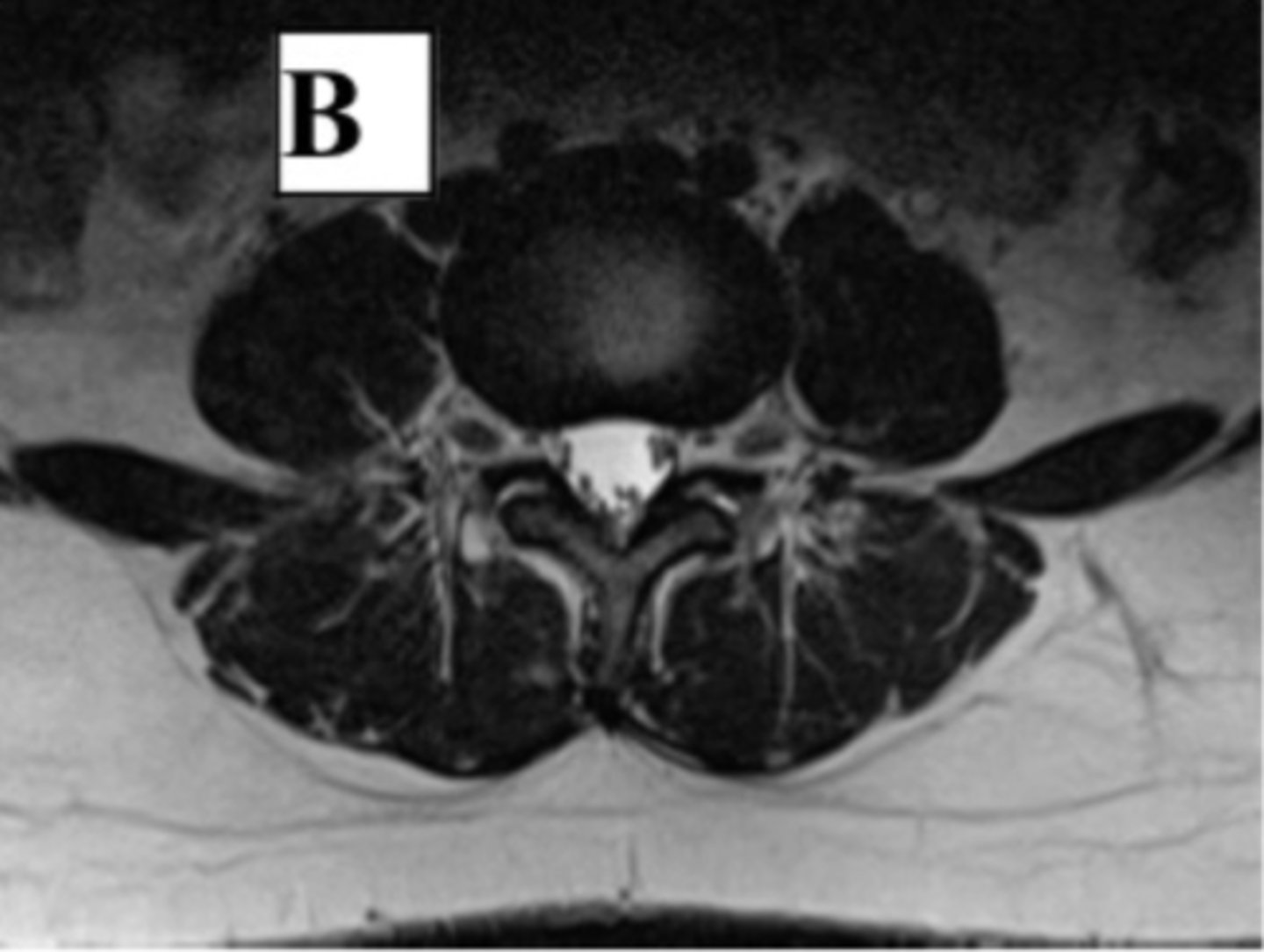 <p>axial cross section</p>
