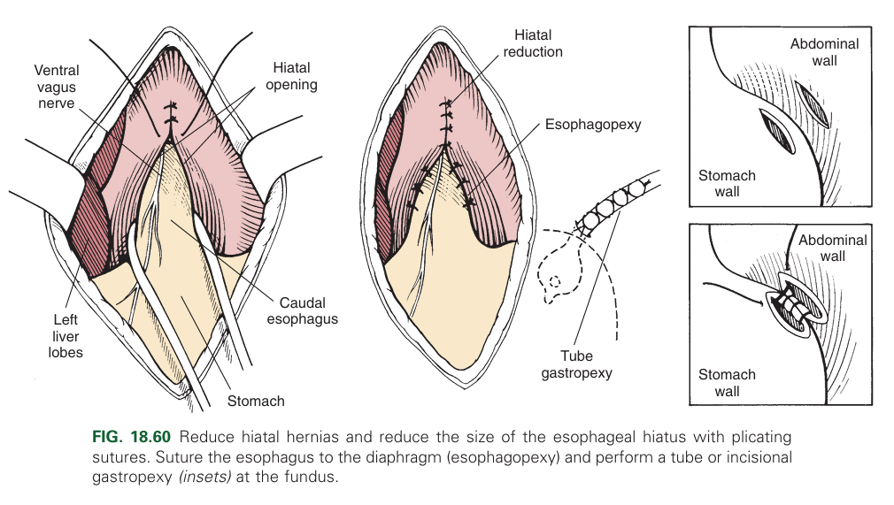 <ol><li><p>Diaphragmatic hiatal reduction</p></li><li><p>Left side gastropexy (most important)</p></li><li><p>Diaphragmatic plication (flattening of the diaphragm).</p></li></ol><p></p>