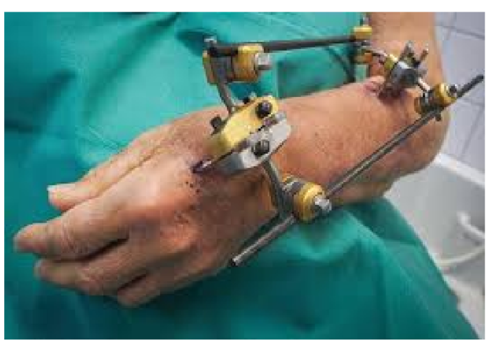 <p>What is this?</p>