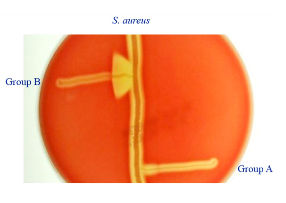 <p>Name this test</p><p>What is the use of this test</p><p>Which side is positive?</p><p>What organism benefits?</p>