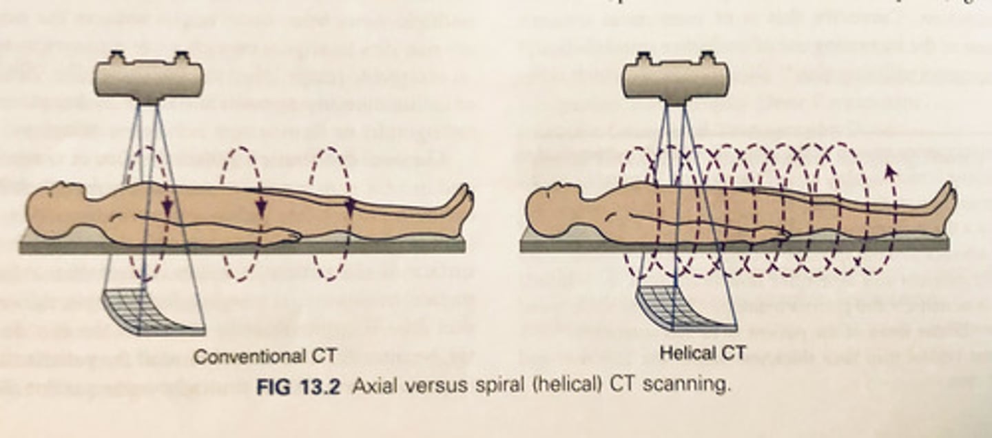 <p>3D reconstruction of images </p>