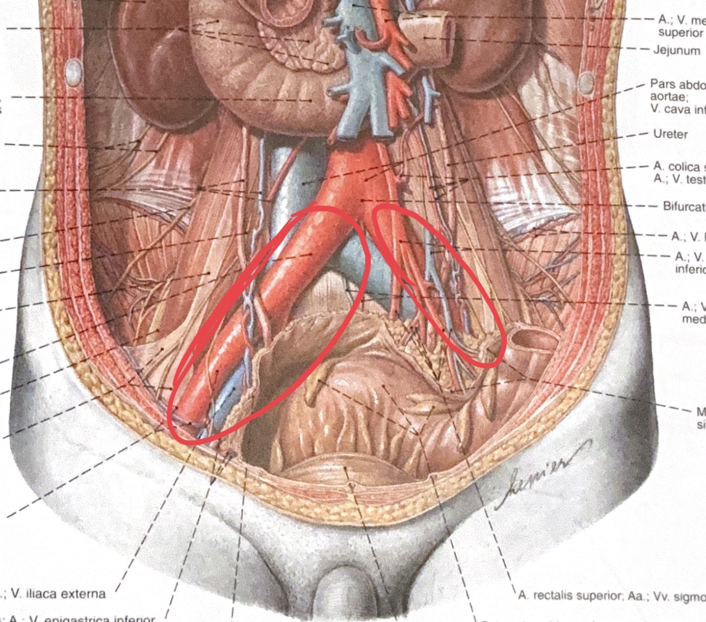 <p>arteria iliaca communis</p>