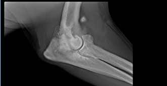 <p>Patient preparation for Adaptix </p>