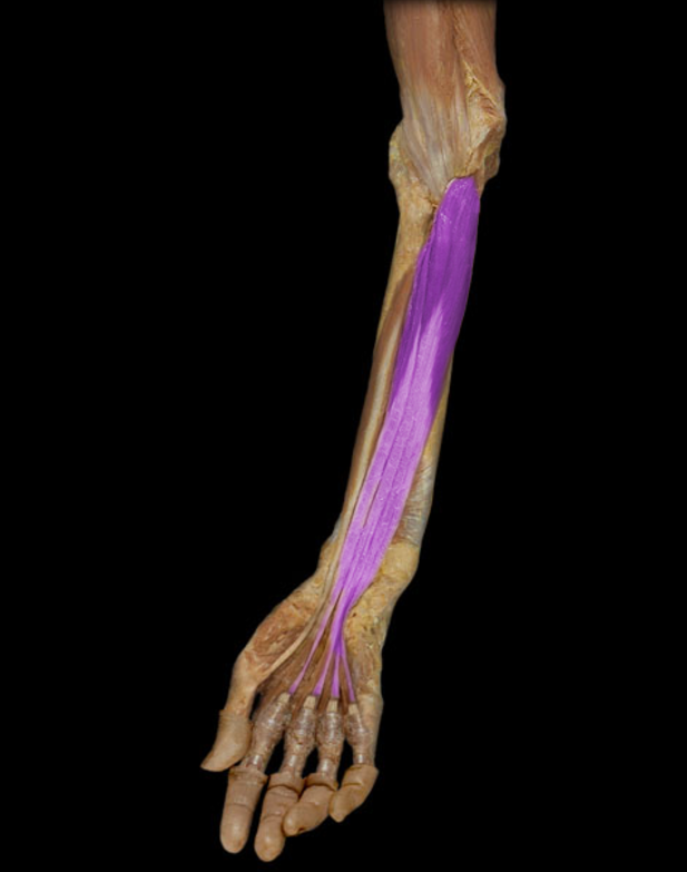 <p>Flexor digitorum profundus</p>