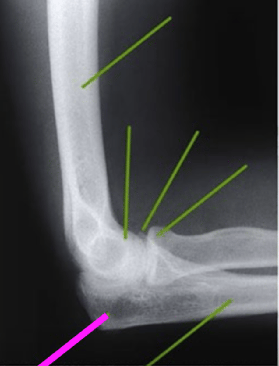 <p>what does the pink line point to?</p>