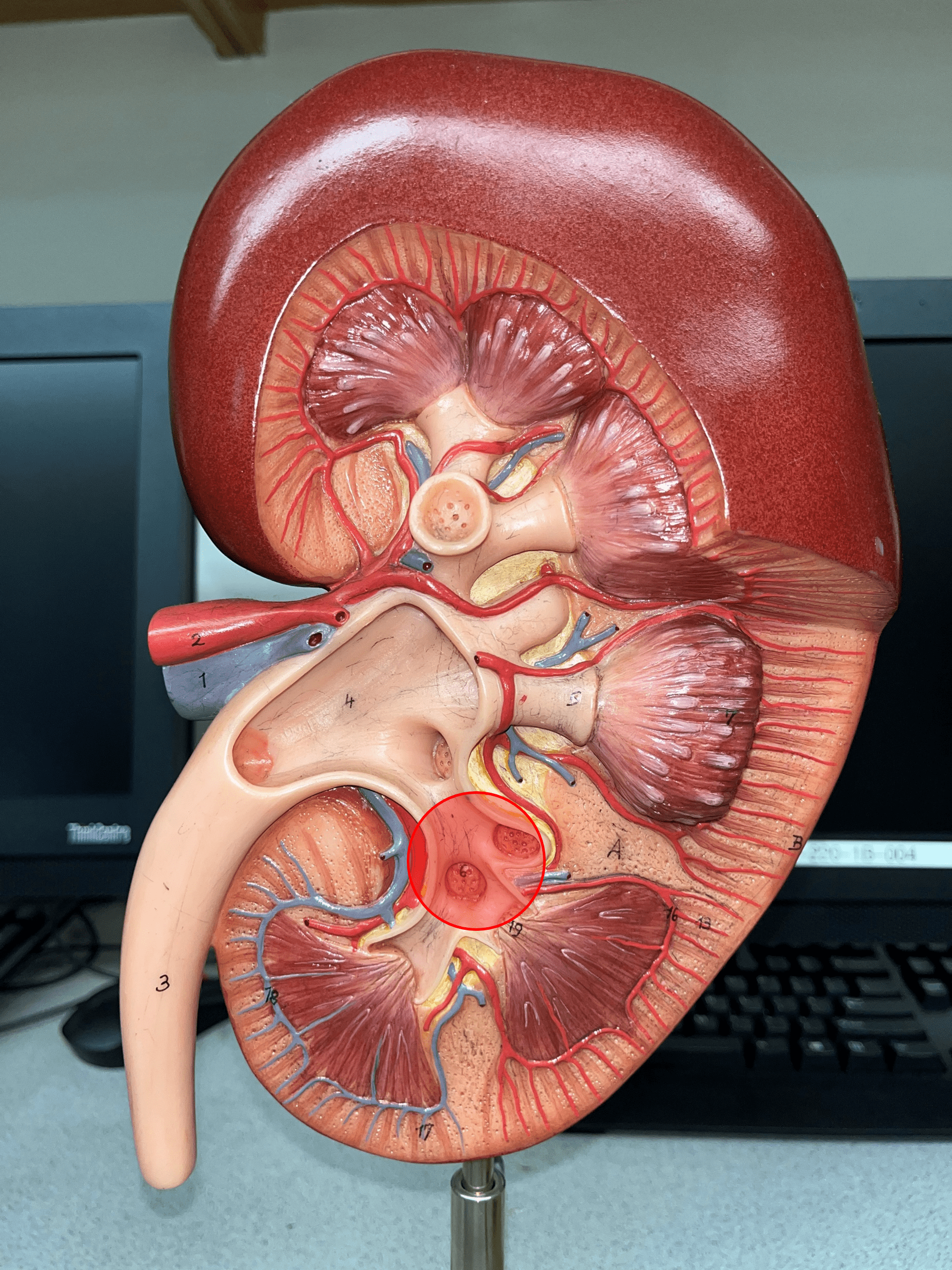 • The convergence of several minor calyces.

• Drains into the renal pelvis.