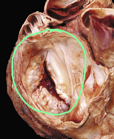 <p>What is circled?</p>