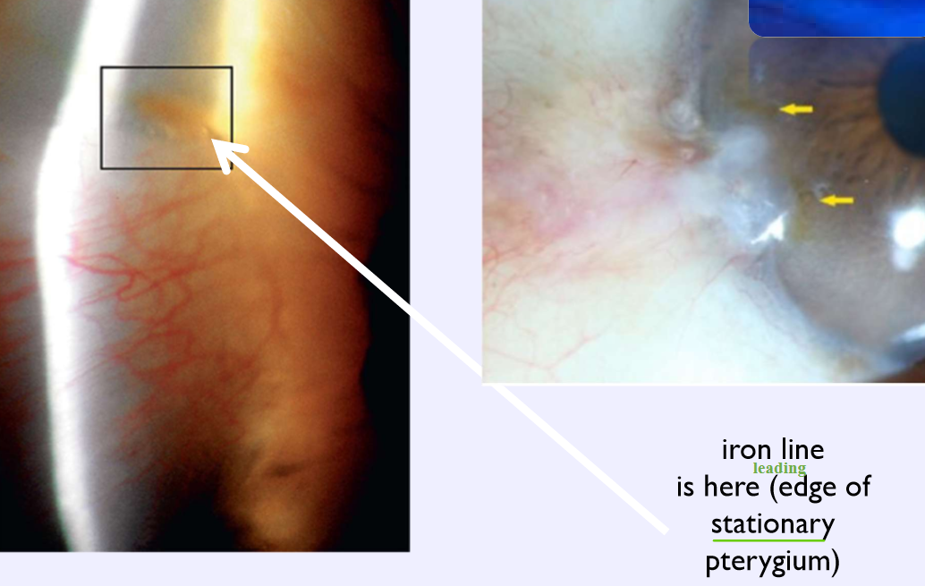 <p>What condition is this?</p>