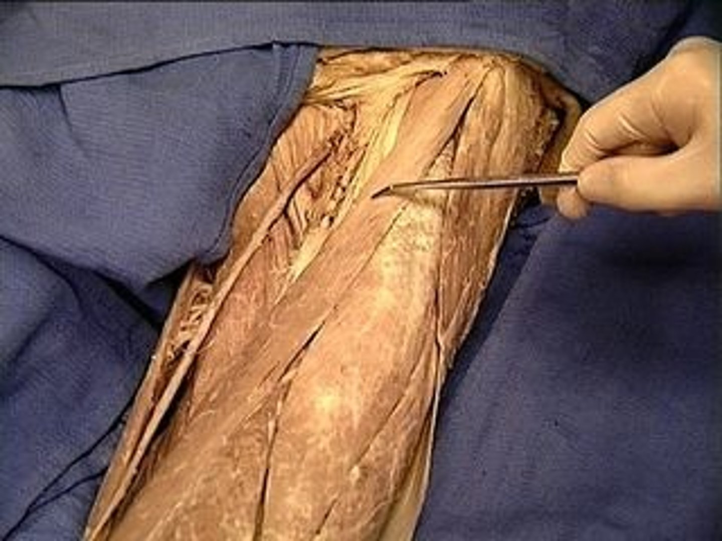 <p>Flexes, abducts, and laterally rotates thigh at the hip; flexes knee; A long, narrow muscle running obliquely across the front of each thigh from the hipbone to the inside of the leg below the knee.</p>