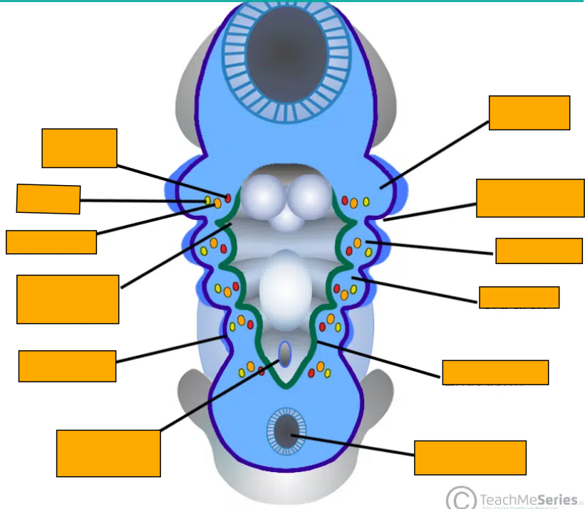 <p>Label this image </p>