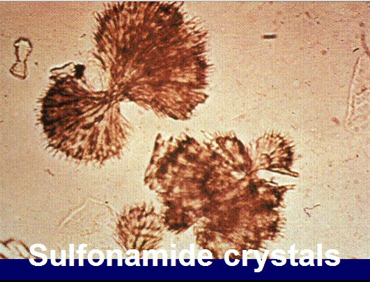 <ul><li><p>sheaves of needles</p></li><li><p>associated with sulfa medications</p></li><li><p>can lead to tubular damage </p></li></ul><p></p>