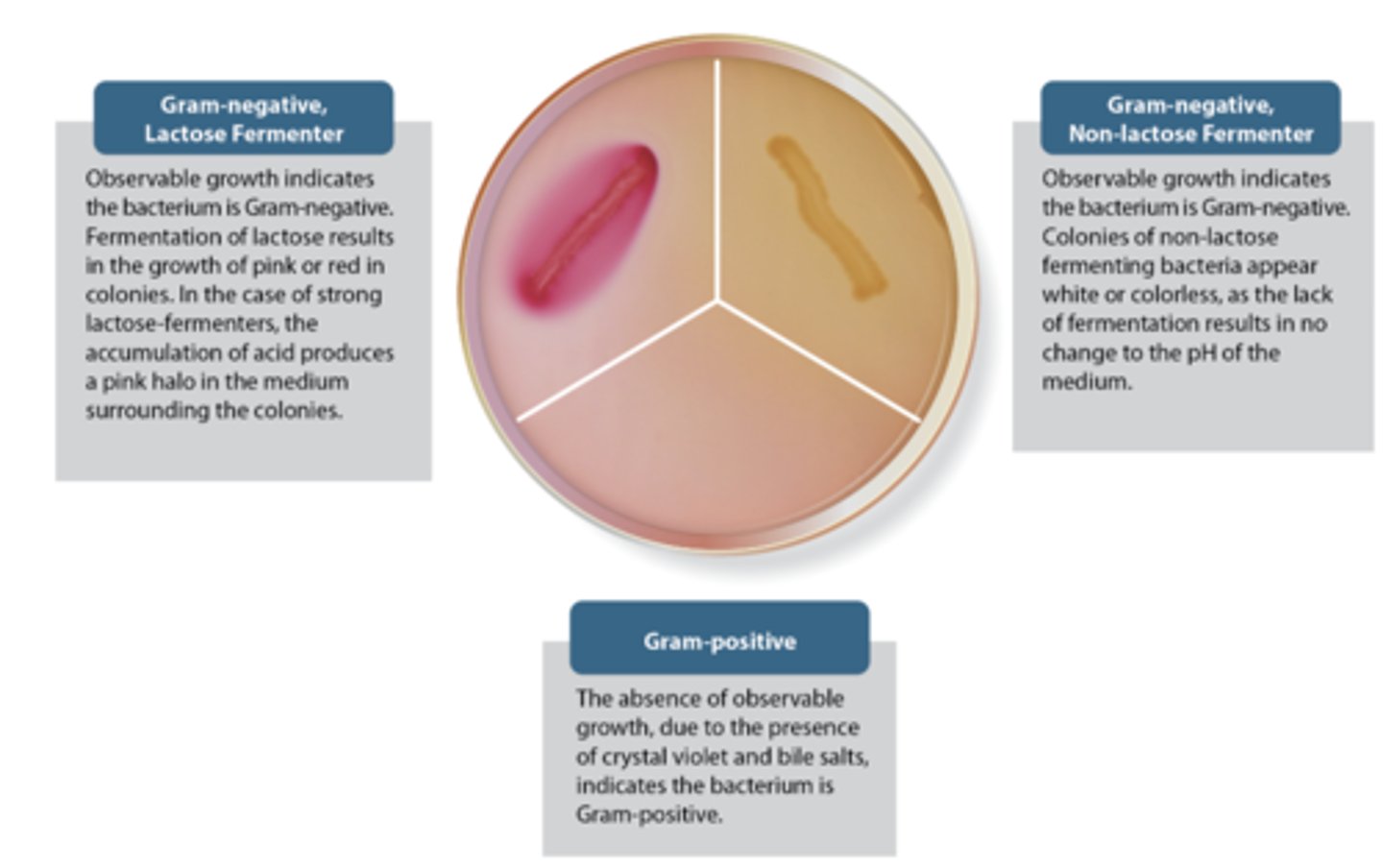 <p>What are the two results that you can get from the MacConkey agar experiment?</p>