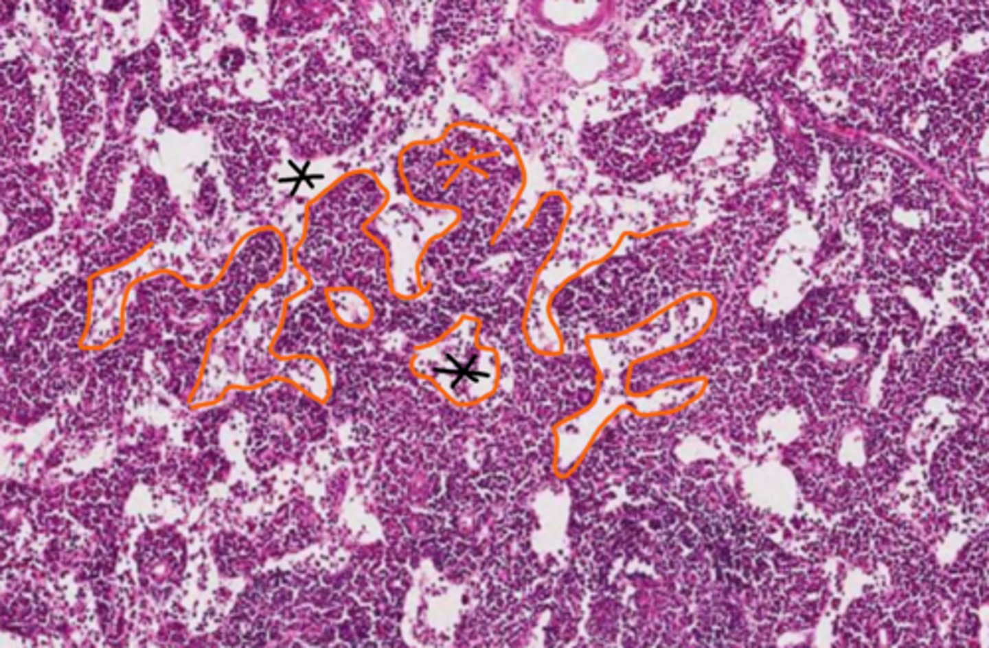 <p>orange outlines and ***</p>