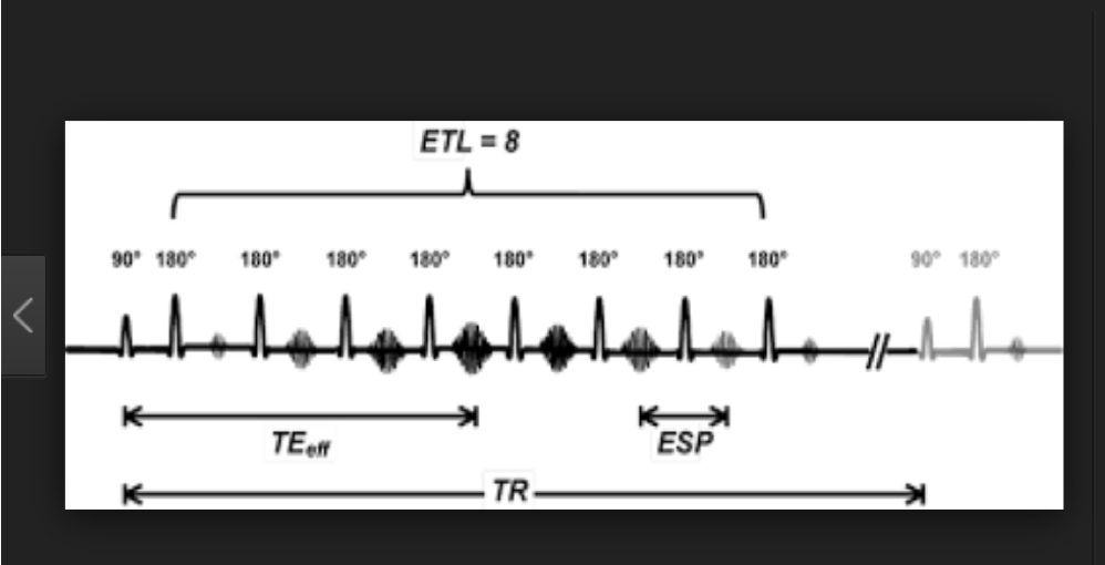 <p>turbo spin echo</p>