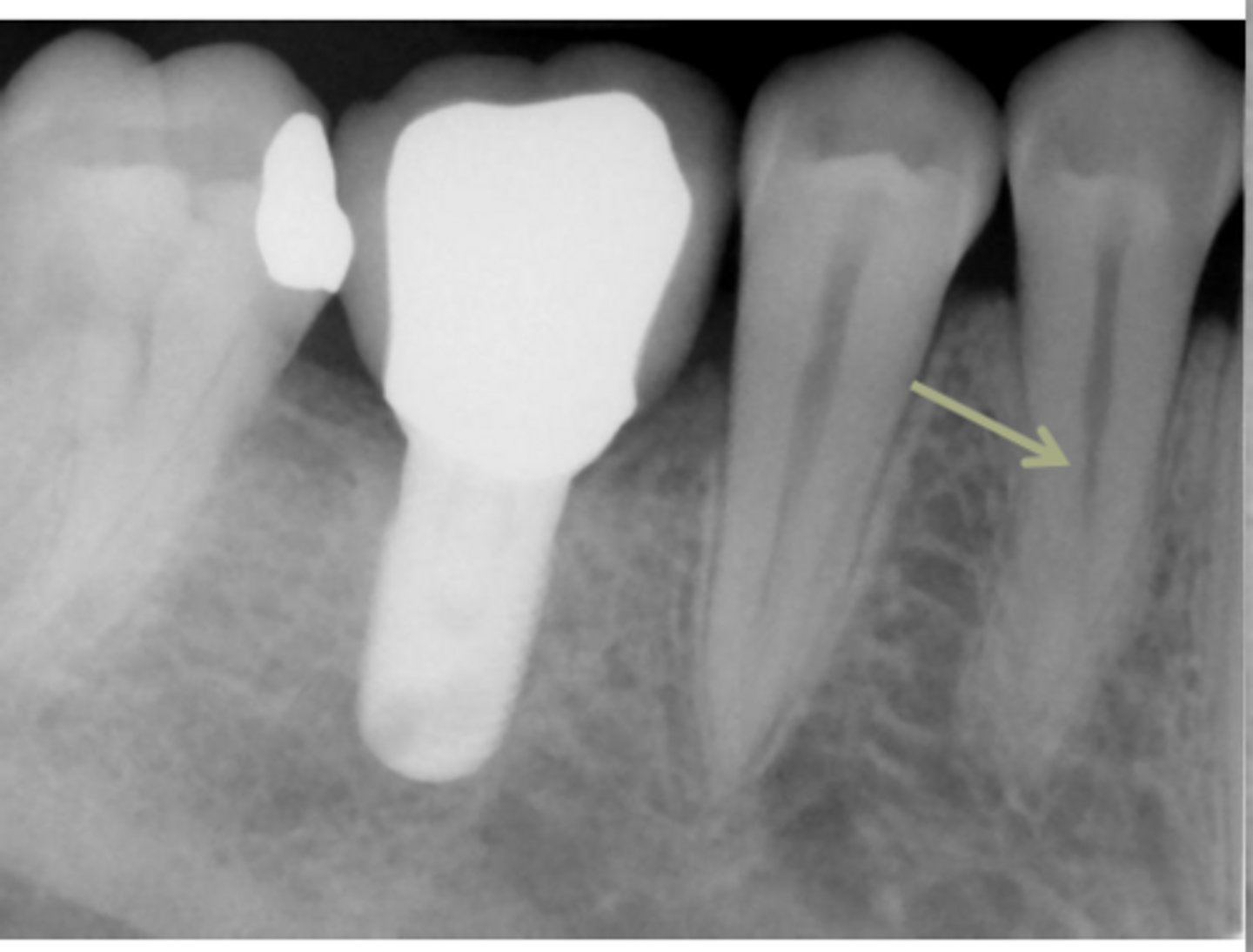 <p>ID the problem:</p>