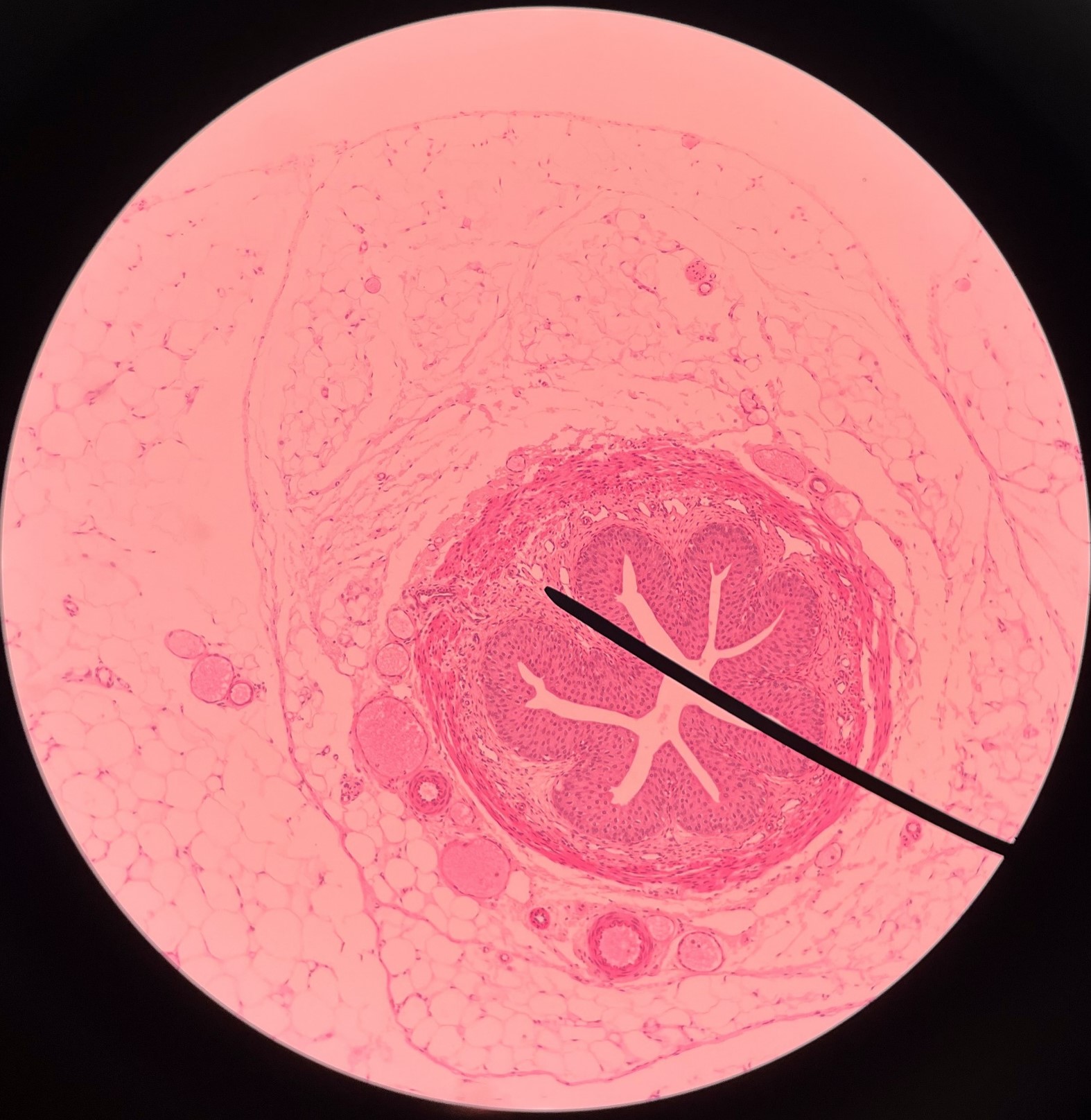 • Slide histology of the ureter.

• A smooth muscle layer of the ureter.

• Superficial to the mucosa and deep to the circular layer of the muscularis.