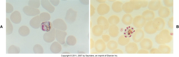 72 hour fever cycle
invades older RBC
band form of troph
