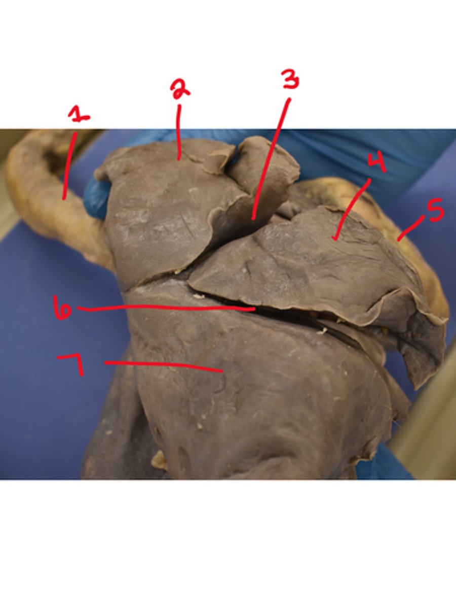 <p>What is structure #6</p>