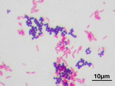 Cell walls rich in peptidoglycan 
No outer lipopolysaccharide layer
After staining: appear blue or purple
example slides are:
Bacillus substilis, Micrococus luteus,
Streptococus lactis, Staphylococus