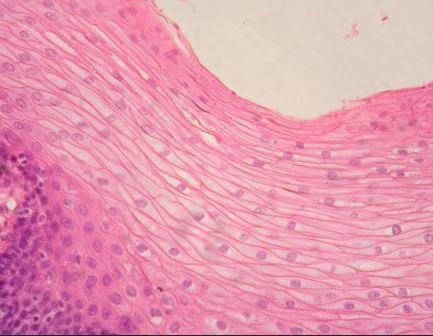 <p>What epithelial tissue is this?</p>