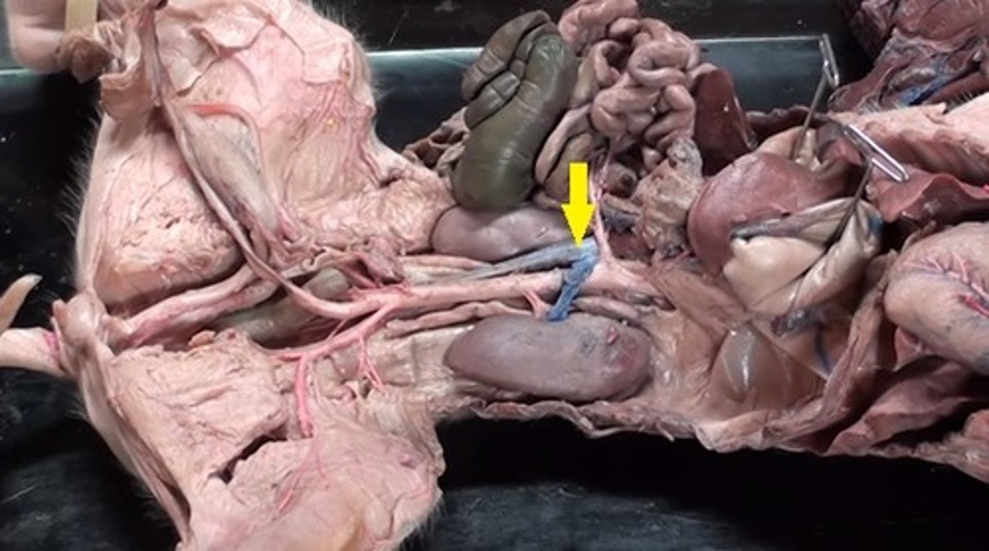 <p>Inferior vena cava</p>