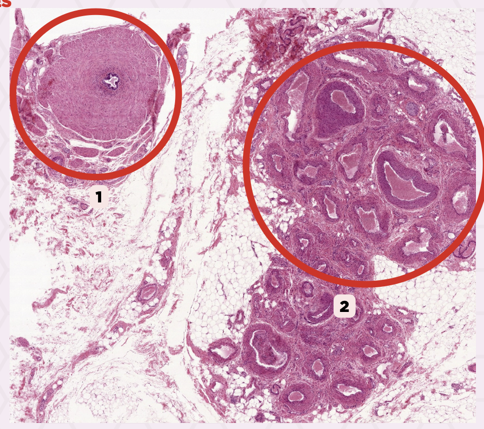 <p>Identify the structure labeled as 1.</p>