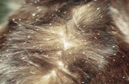 <p>what kind of mite</p>