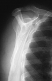 <p><span style="color: rgb(255, 255, 255);">name the position'/projection </span></p>