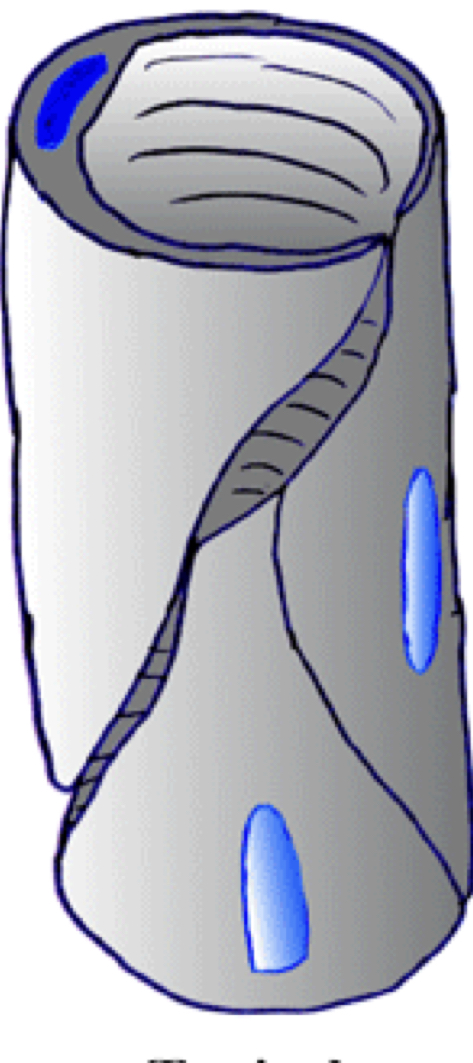 Capillary type and location found 