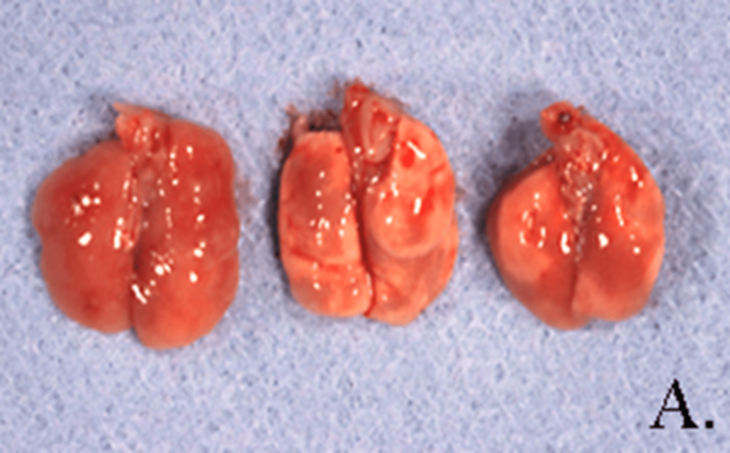 <p>The lungs pictured are pale, fleshy (rubbery) and fail to collapse. What is the likely etiologic agent?</p>