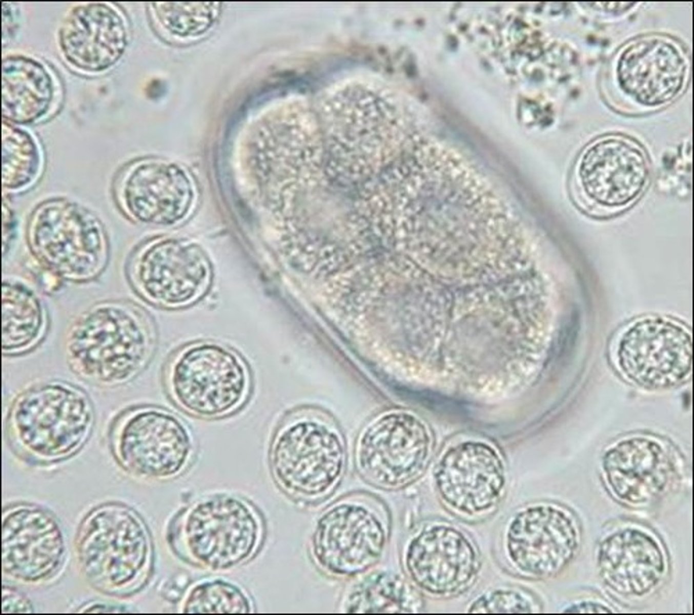 <p>ID the following parasite (cat)</p><p>10-12 um</p>