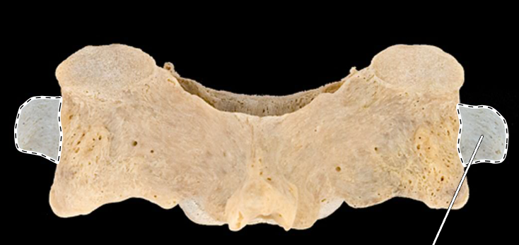 <p>What part of the vertebra is highlighted?</p><p>What type of vertebra is this (which region is this vertebra from)?</p><p>(Posterior view).</p>