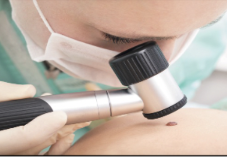 <p>Inspection of the skin during dermatologist visit; may involve all of the skin or a specific rash or lesion.</p>