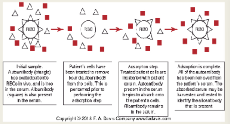 <ul><li><p><span>Preferred method to remove autoantibodies</span></p></li><li><p><span>Use of <u>patient cells</u> to remove autoantibody that may be masking the presence of an alloantibody</span></p></li><li><p><span>preferably done when patient has not been recently transfused (last 90-120 days)</span></p></li><li><p><span>RBCs not heavily coated with immunoglobulin (may require treatment)</span></p></li><li><p><span><u>Most suitable technique to detect alloantibodies in the presence of warm autoantibodies</u></span></p><ul><li><p><span>Only autoantibody will be removed</span></p></li><li><p><span>Avoids removing alloantibody to high prevalence antigen&nbsp;&nbsp;</span></p></li></ul></li></ul><p></p>
