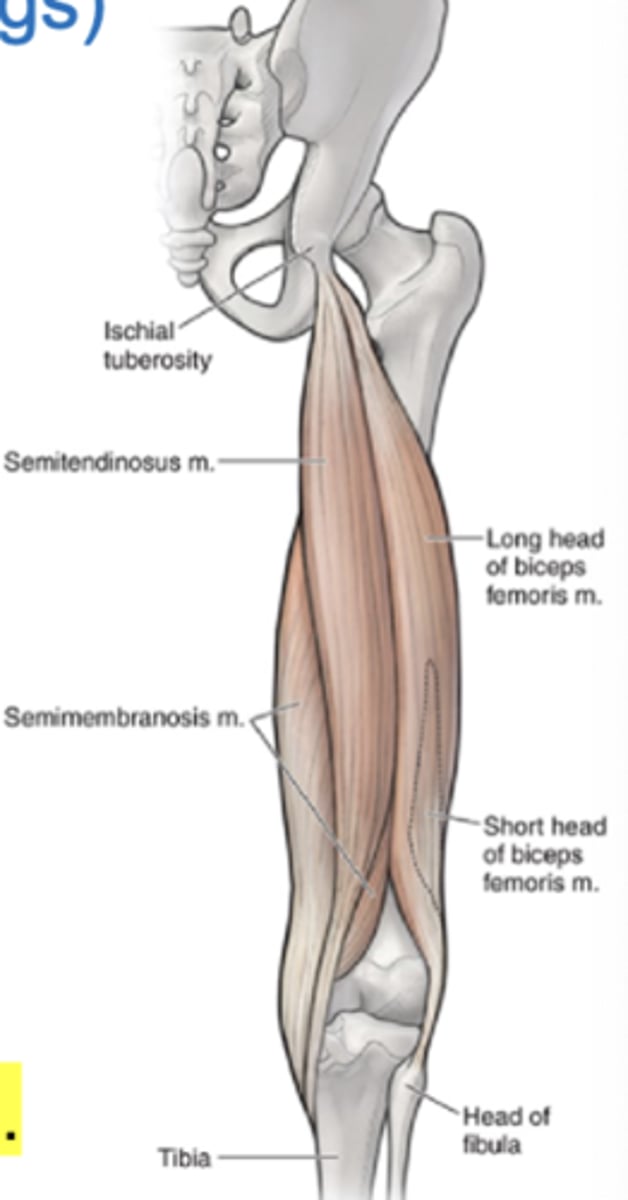 <p>Another name for posterior thigh muscles</p>