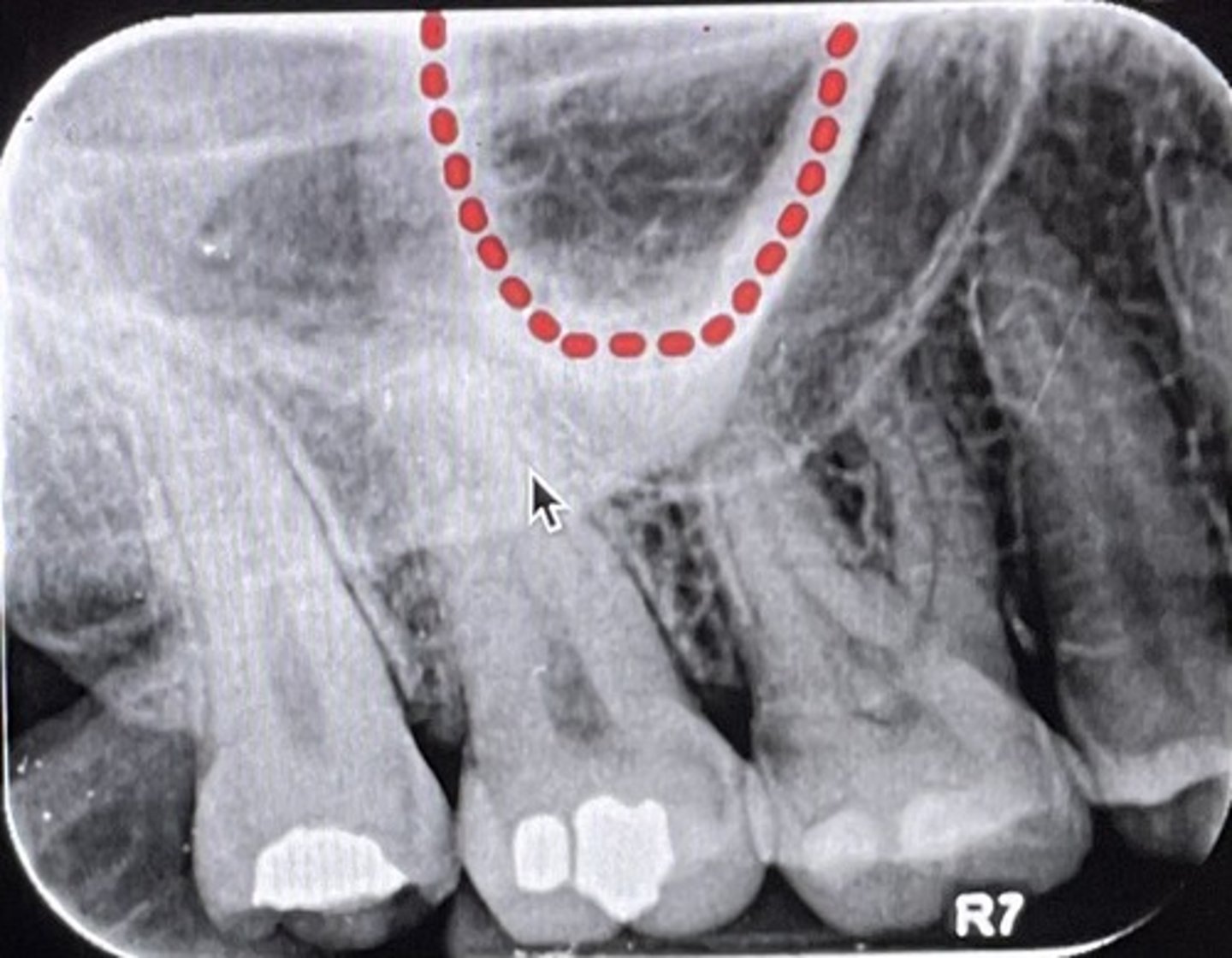 <p>What is the red dotted line circling?</p>