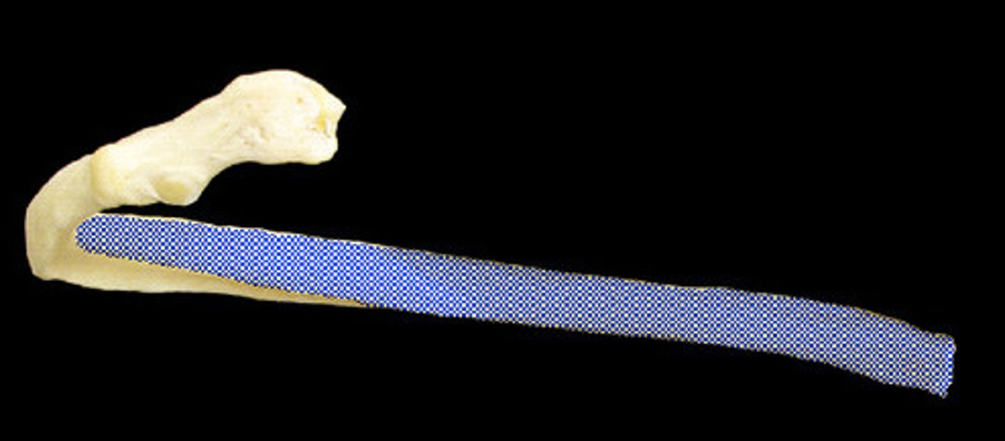 <p>Curved main part of rib</p>