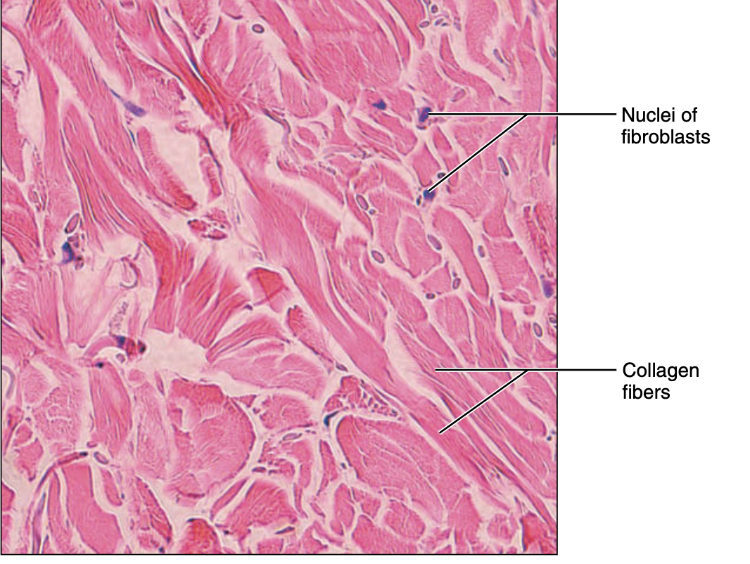 <p>dense irregular connective tissue </p>