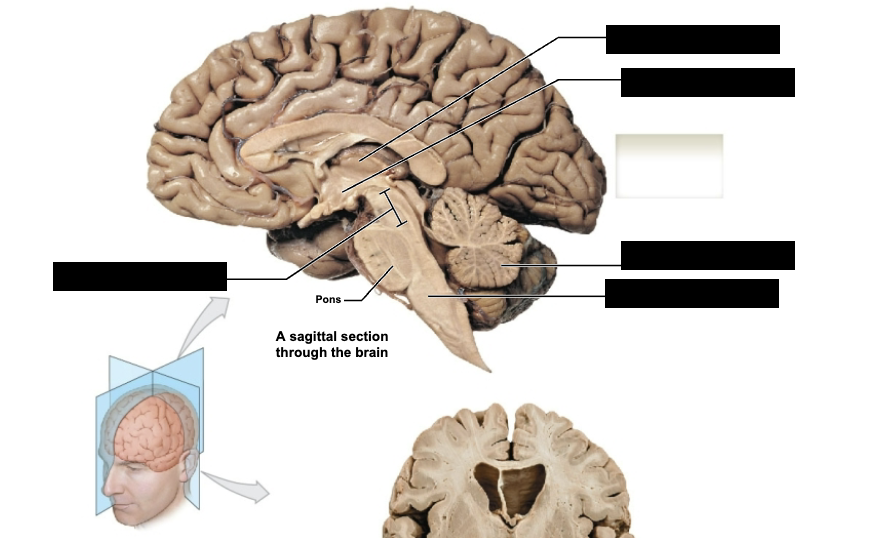 <p>label sagittal section through brain</p>