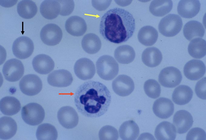 <p>What cell is the black arrow pointing to?</p>