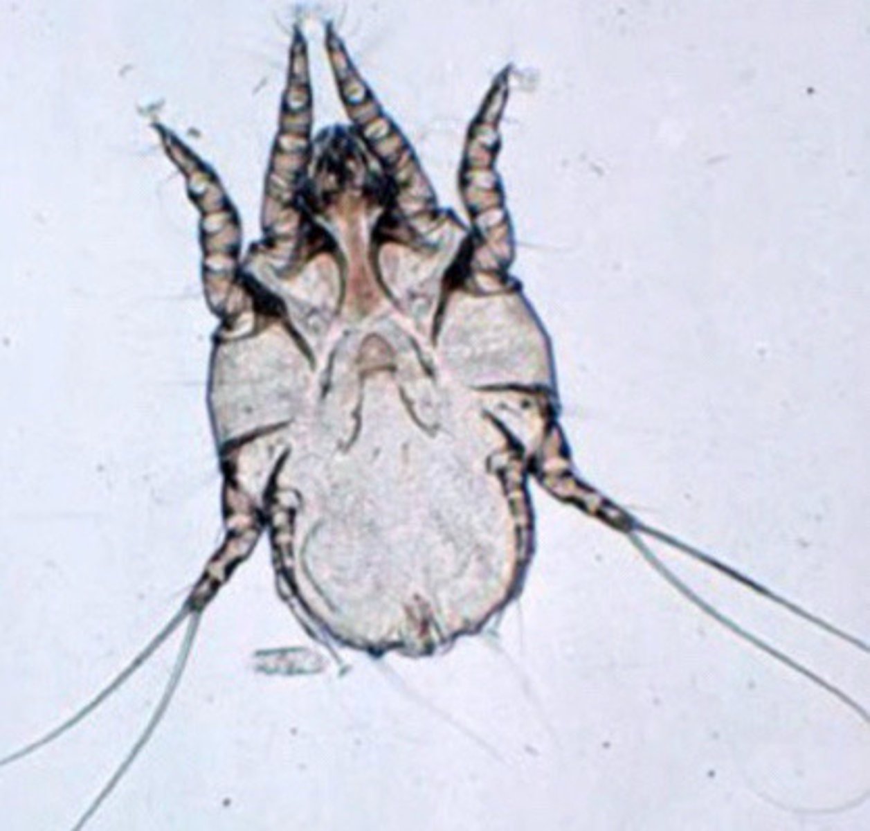 <p>What is this, found on the hind legs, udders, scrotum, tail, and perineum, starting at the pastern and spreading up the legs of cows?</p><p>a. psoroptic mange</p><p>b. chorioptic mange</p><p>c. sarcoptic mange</p>