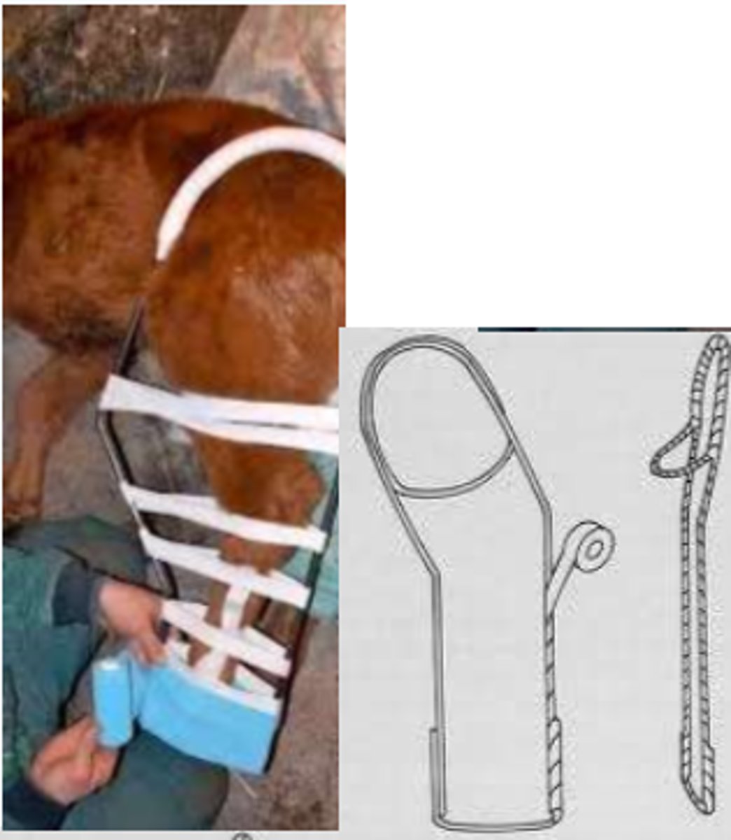 <p>used to support and protect injured bones</p>