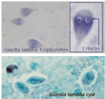 <p>Giardia lamblia</p>