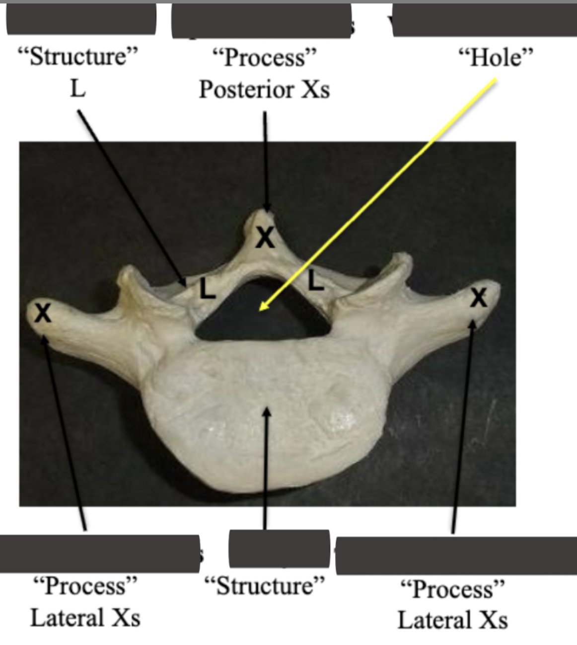 <p>Label the <strong>side process x</strong></p>