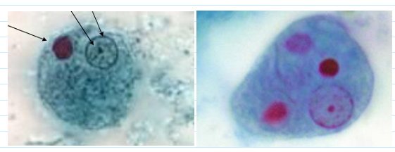 <ul><li><p>Thin, delicate chromatin ring</p></li><li><p>Central, compact karyosome</p></li><li><p><u>Ingested RBC</u></p><ul><li><p>Not always present</p></li></ul></li><li><p>Size 20 u (usually 15-20; can be 10-60u)</p></li></ul><p></p>
