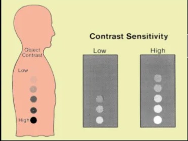 <p>how do you calculate MRI signal/contrast sensitivity?</p>