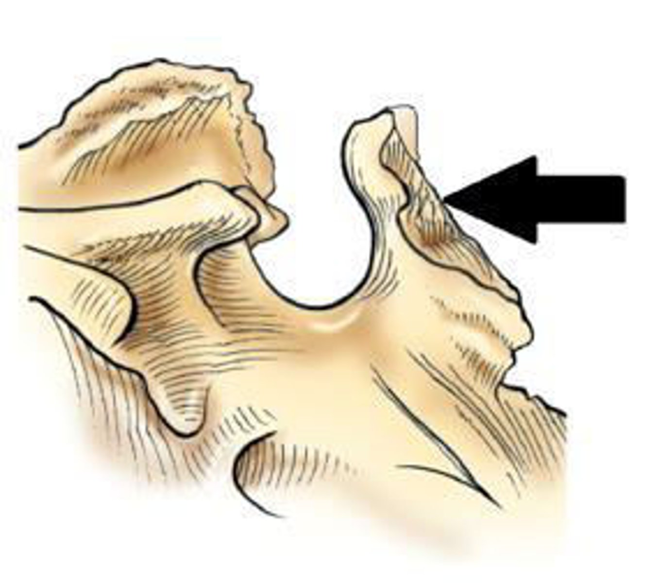 <p>d. dorsum sellae.</p>