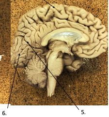 <p>What is the <strong><em>Sulci and Fissures</em></strong> of #6?</p>